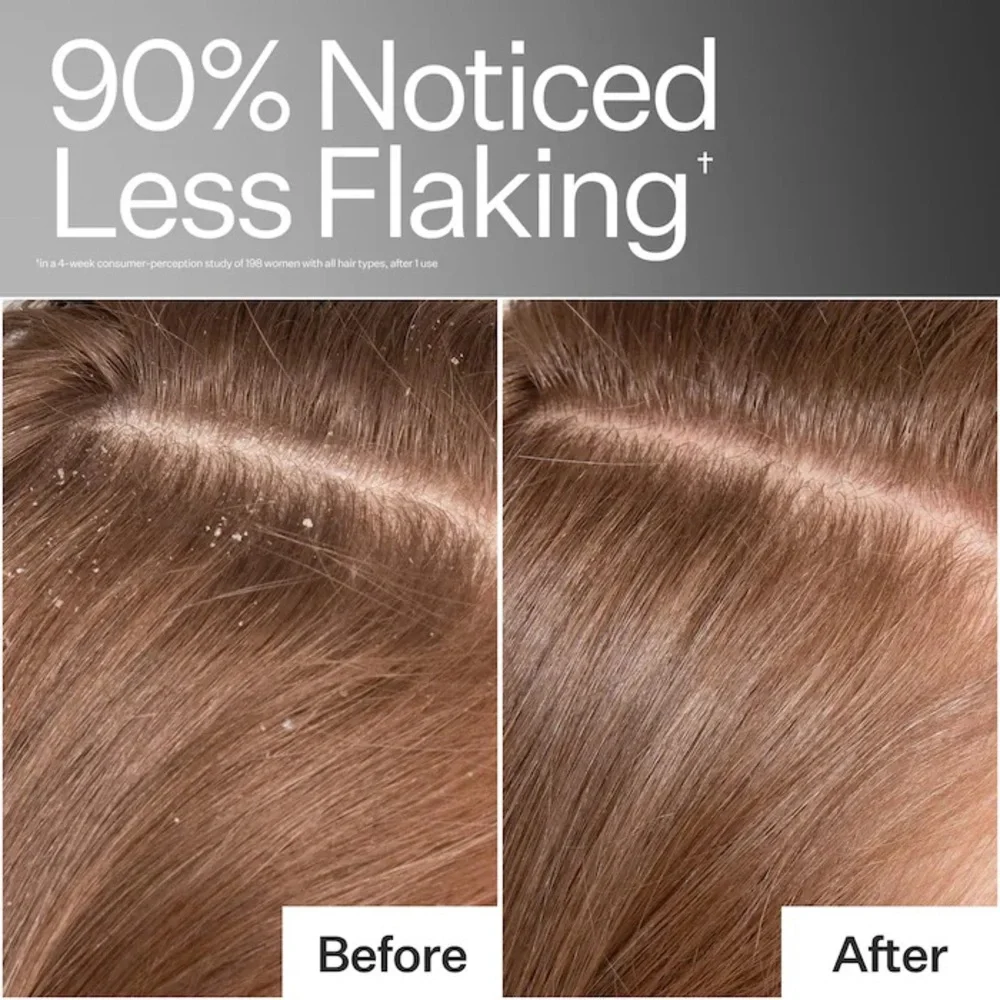 Act+Acre Cold Processed Scalp Detox Oil For Dry Scalp - Picture 3 of 15